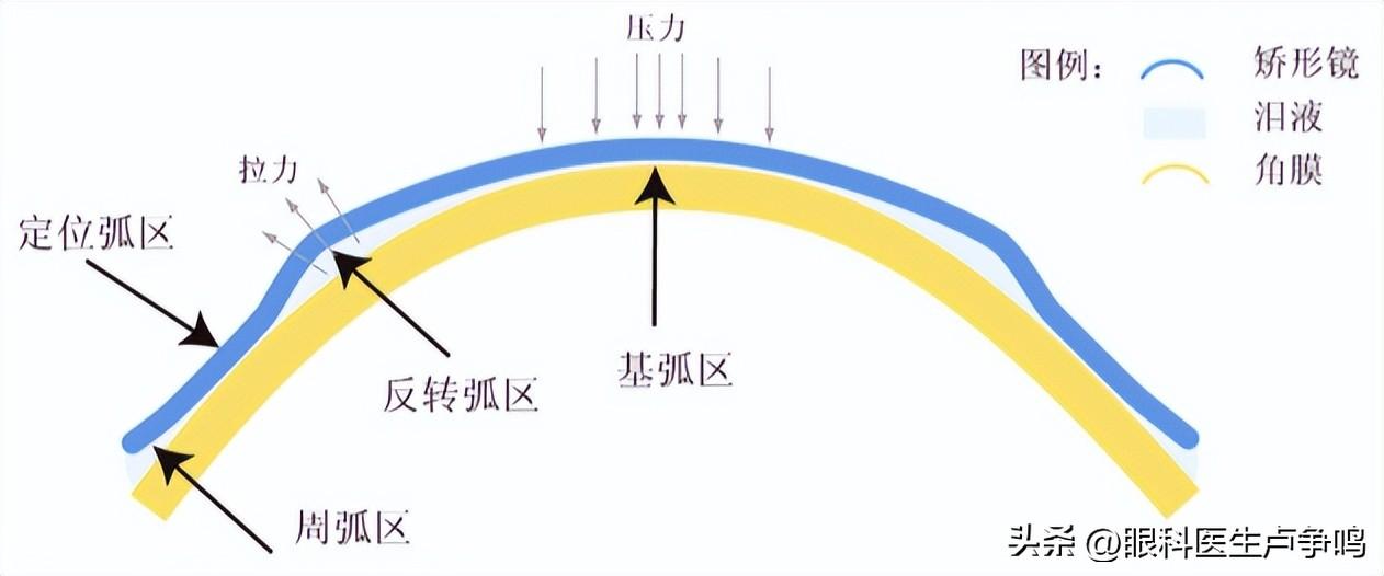 近视最新进展探索，未来视力保护的新篇章实证解答与定义揭秘_M版深度研究